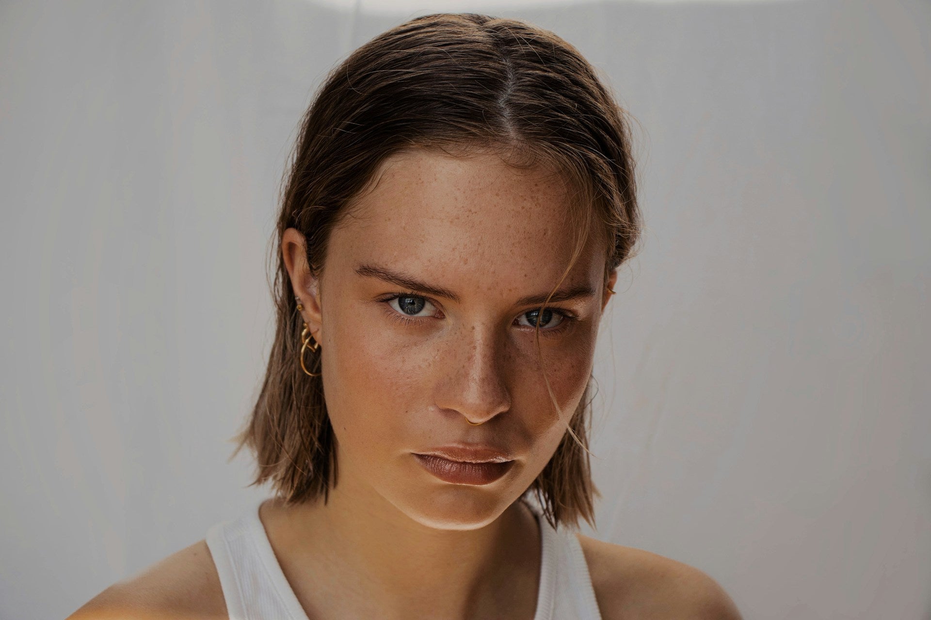 Hyperpigmentation