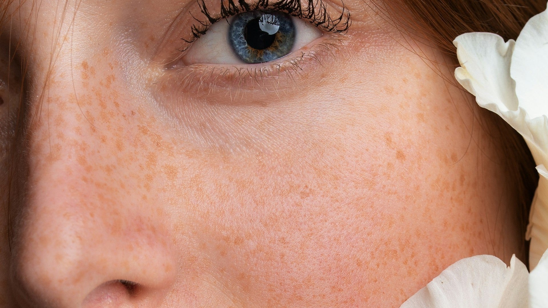 Redness